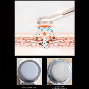 ScrubyOva Ultrasonic Skin Scrubber