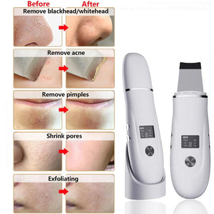 SkinSonyc